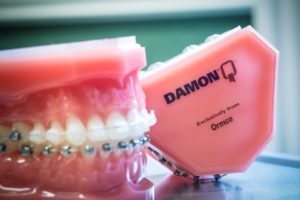 Damon-Clear-Invisalign-Nudera-Orthodontics-Braces-in-Chicagoland-16-300x200  - Braces and Invisalign in South Elgin and Elmwood Park, IL - Nudera Orthodontics