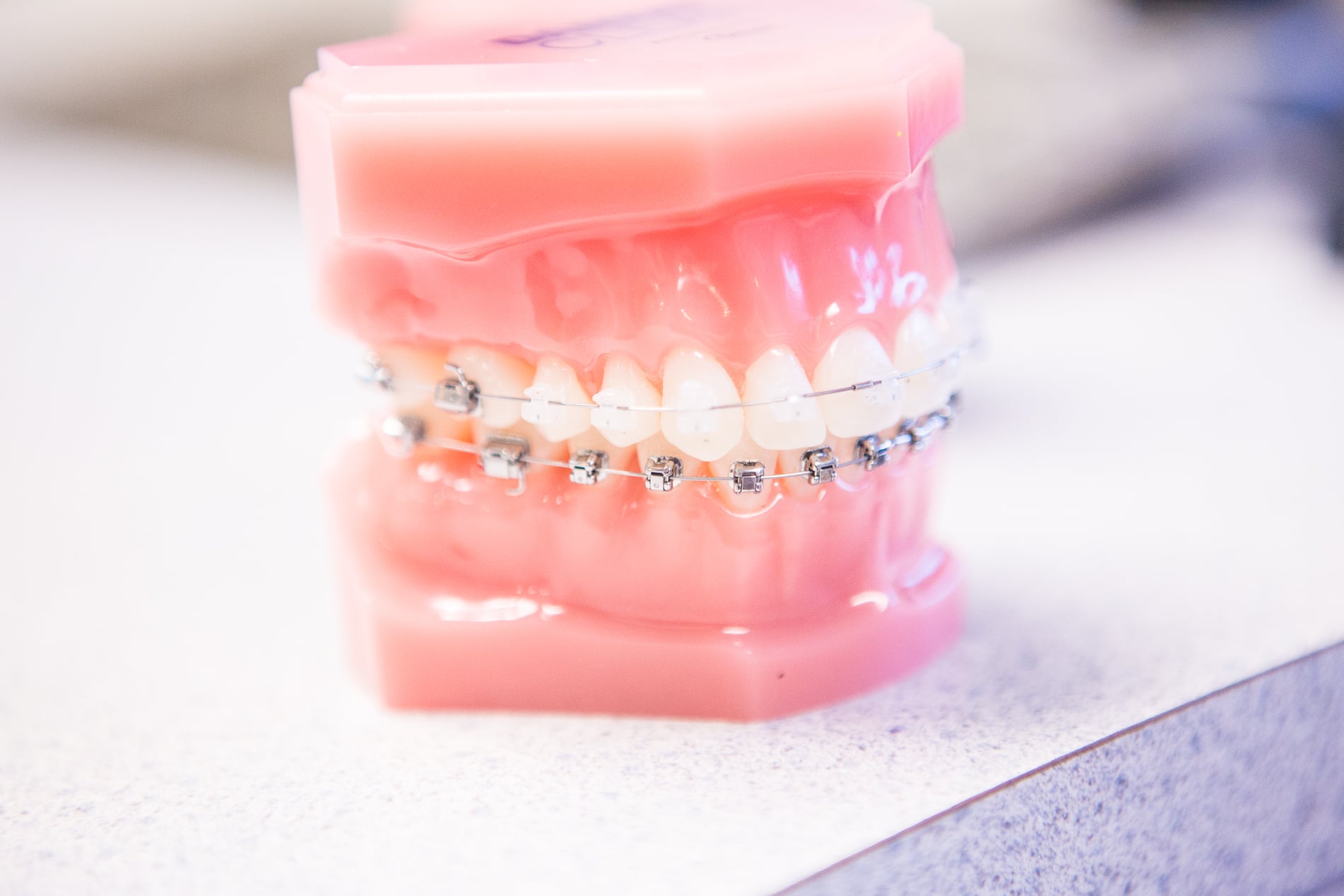 Nudera-Orthodontics-Braces-and-appliances-in-Chicagoland-10-2  - Braces and Invisalign in South Elgin and Elmwood Park, IL - Nudera Orthodontics