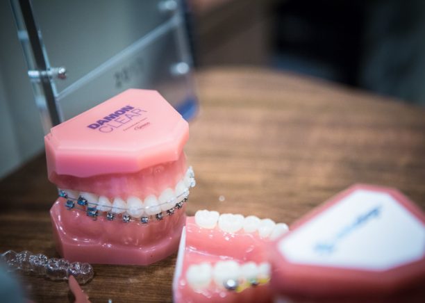 Nudera-Orthodontics-Braces-and-appliances-in-Chicagoland-21-612x436  - Braces and Invisalign in South Elgin and Elmwood Park, IL - Nudera Orthodontics