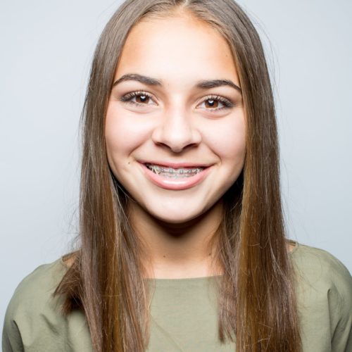 Nudera-Orthodontics-Patient-Portraits-South-Elgin-Elmwood-Braces-8-1-of-13-500x500  - Braces and Invisalign in South Elgin and Elmwood Park, IL - Nudera Orthodontics