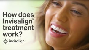 how-does-invisalign-work-thumb-300x169  - Braces and Invisalign in South Elgin and Elmwood Park, IL - Nudera Orthodontics