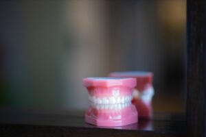 S9vg1xln-300x200  - Braces and Invisalign in South Elgin and Elmwood Park, IL - Nudera Orthodontics